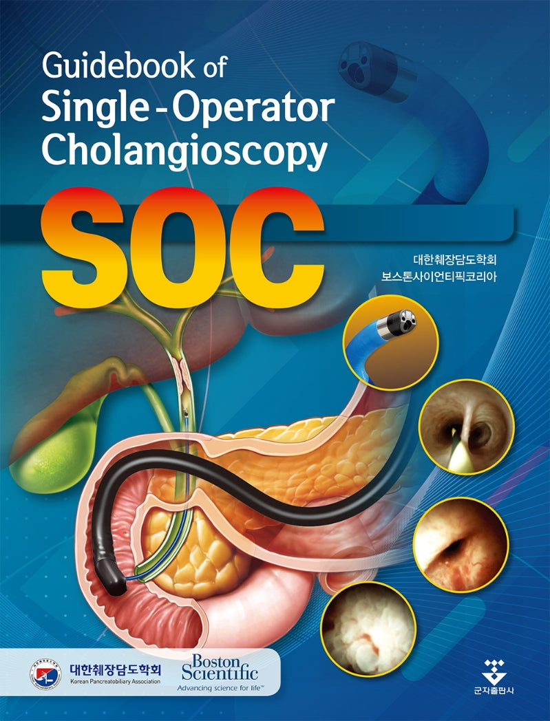 Guidebook of  Single-Operator Cholangioscopy(양장본 Hardcover)