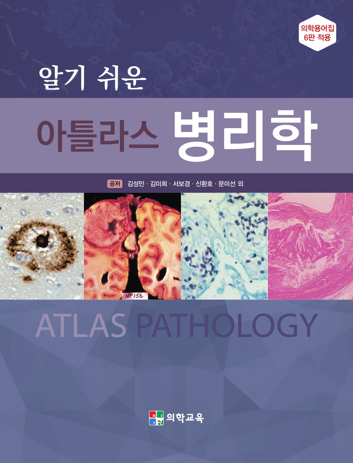 알기 쉬운 아틀라스 병리학