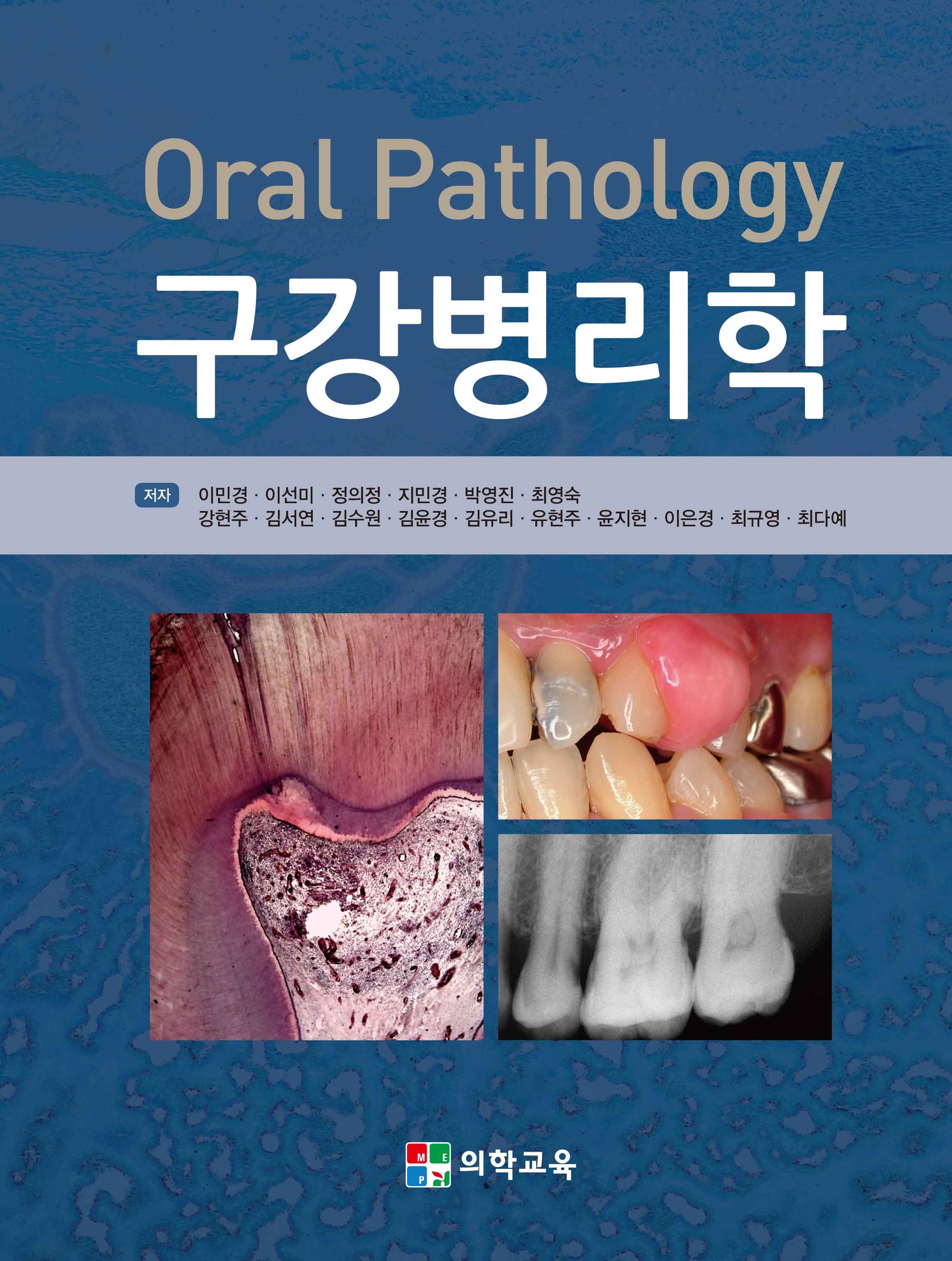 구강병리학(4판)