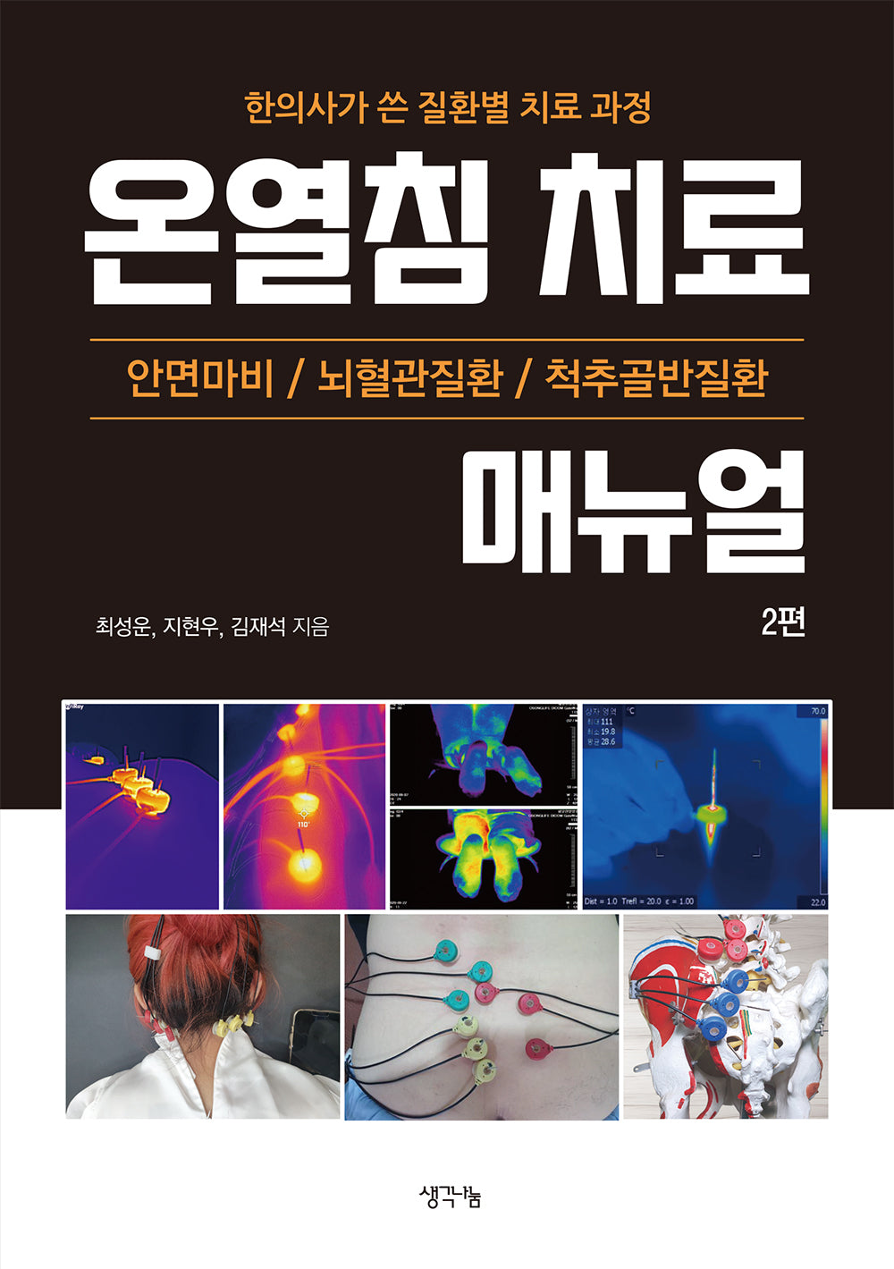 온열침 치료 매뉴얼 2
