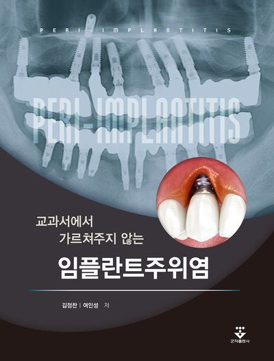 교과서에서 가르쳐주지 않는 임플란트주위염(양장본 Hardcover)
