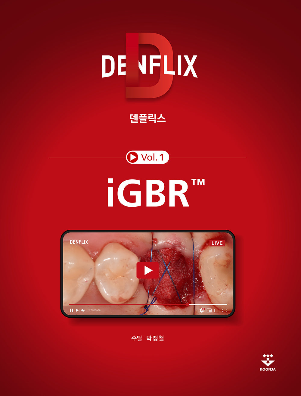 덴플릭스 Vol 1: iGBR(덴플릭스 1)