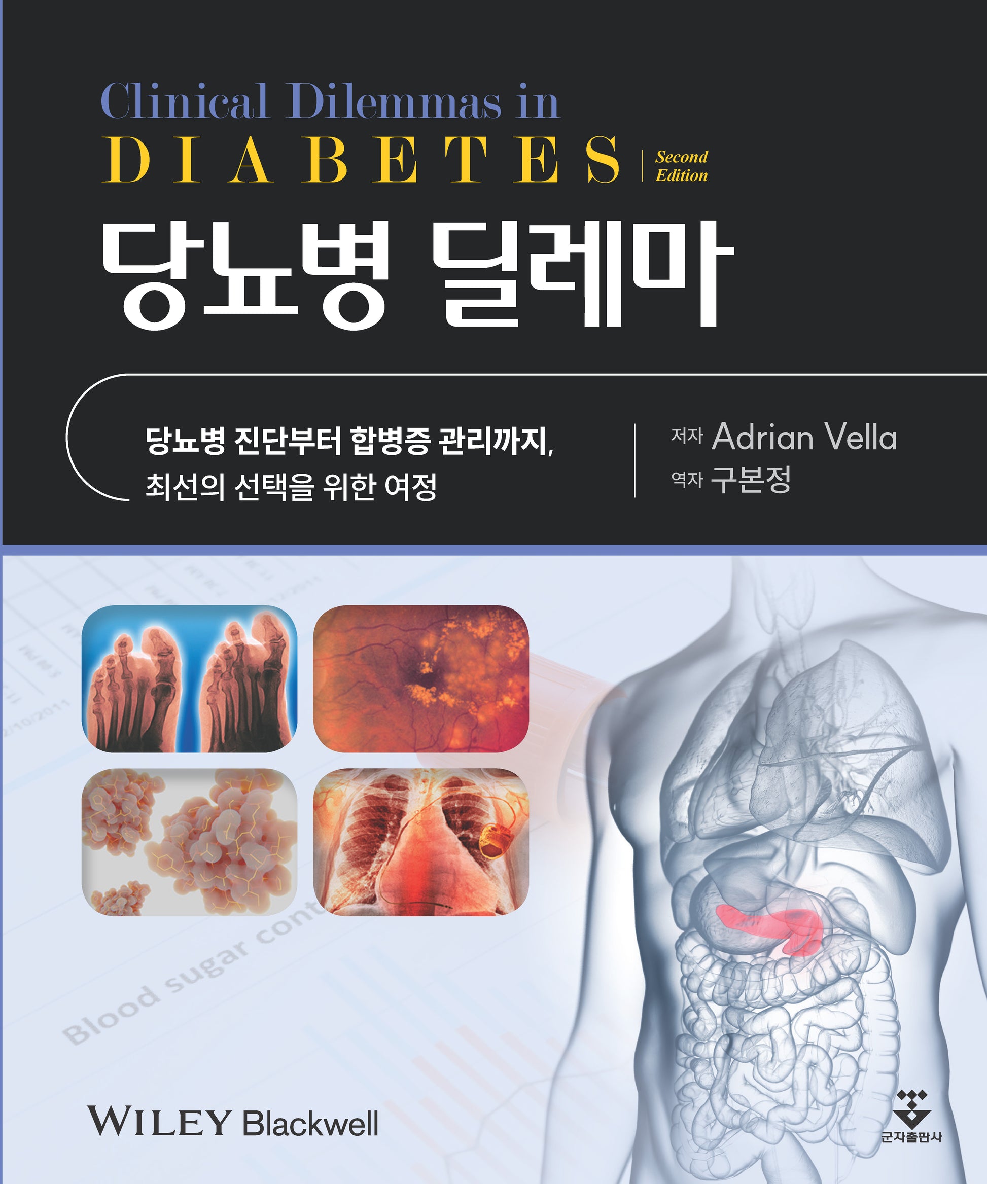 당뇨병 딜레마