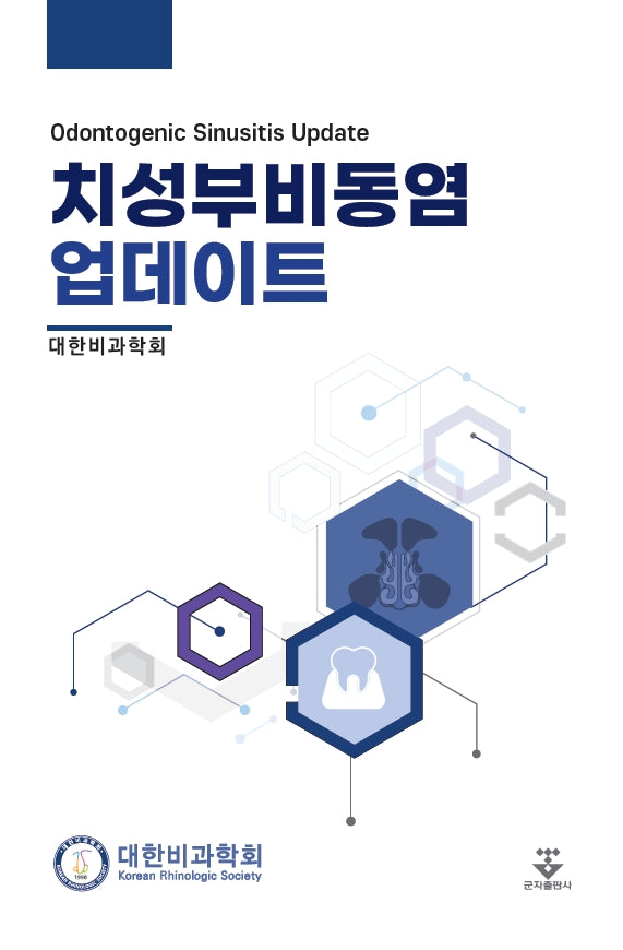 치성부비동염 업데이트