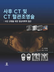 사후 CT 및 CT 혈관조영술(양장본 Hardcover)