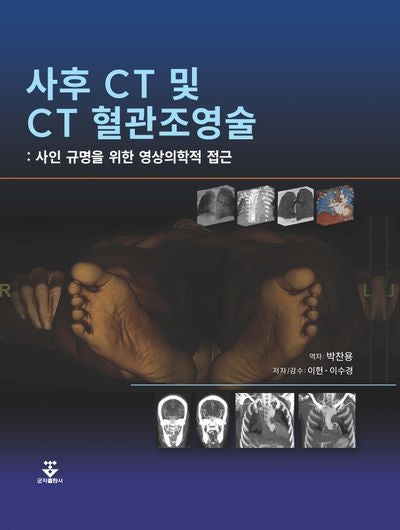 사후 CT 및 CT 혈관조영술(양장본 Hardcover)