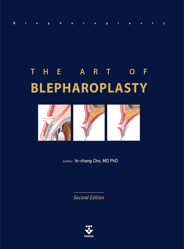 THE ART OF BLEPHAROPLASTY(양장본 Hardcover)