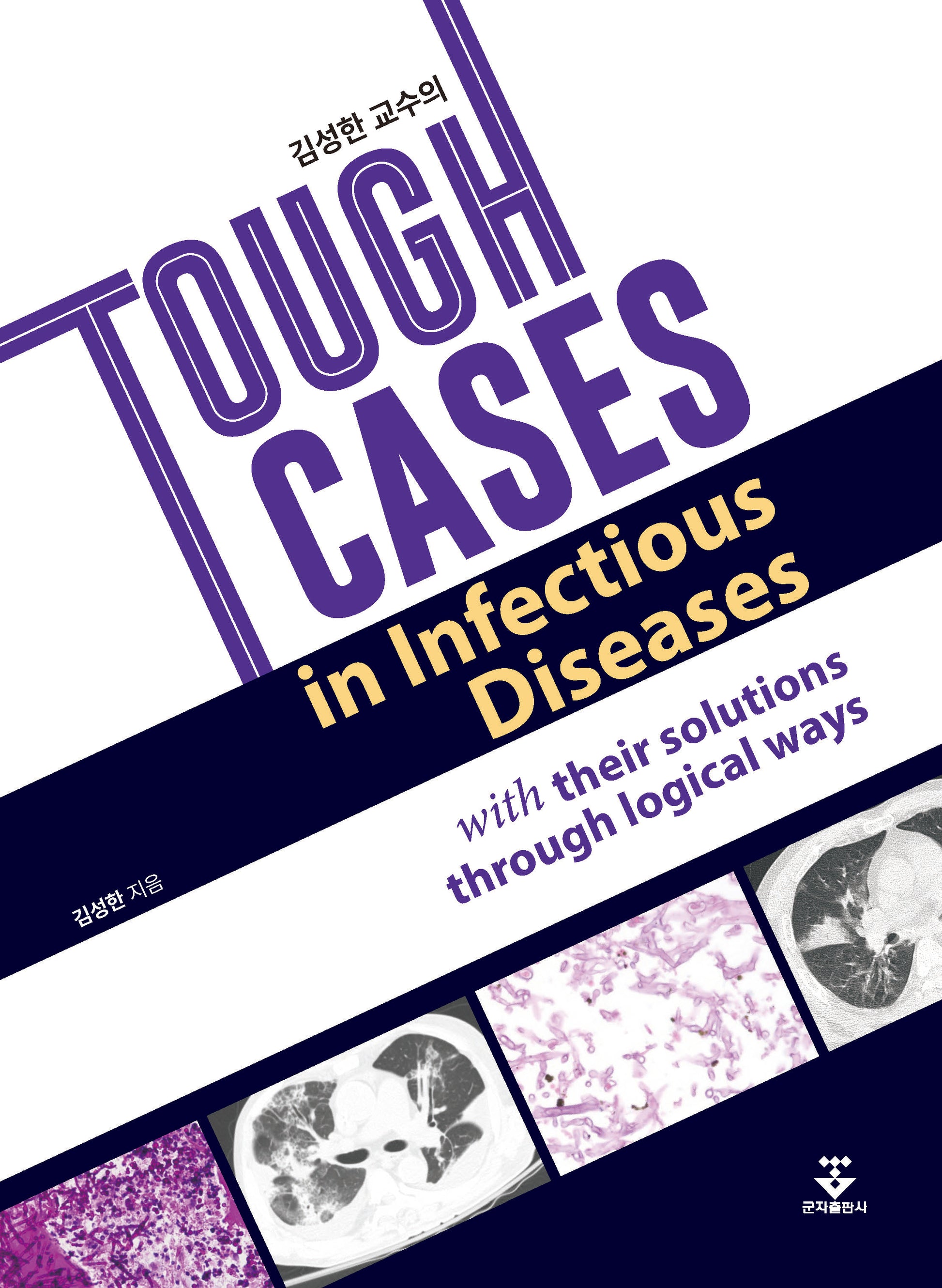 김성한 교수의 Tough Cases in Infectious Diseases