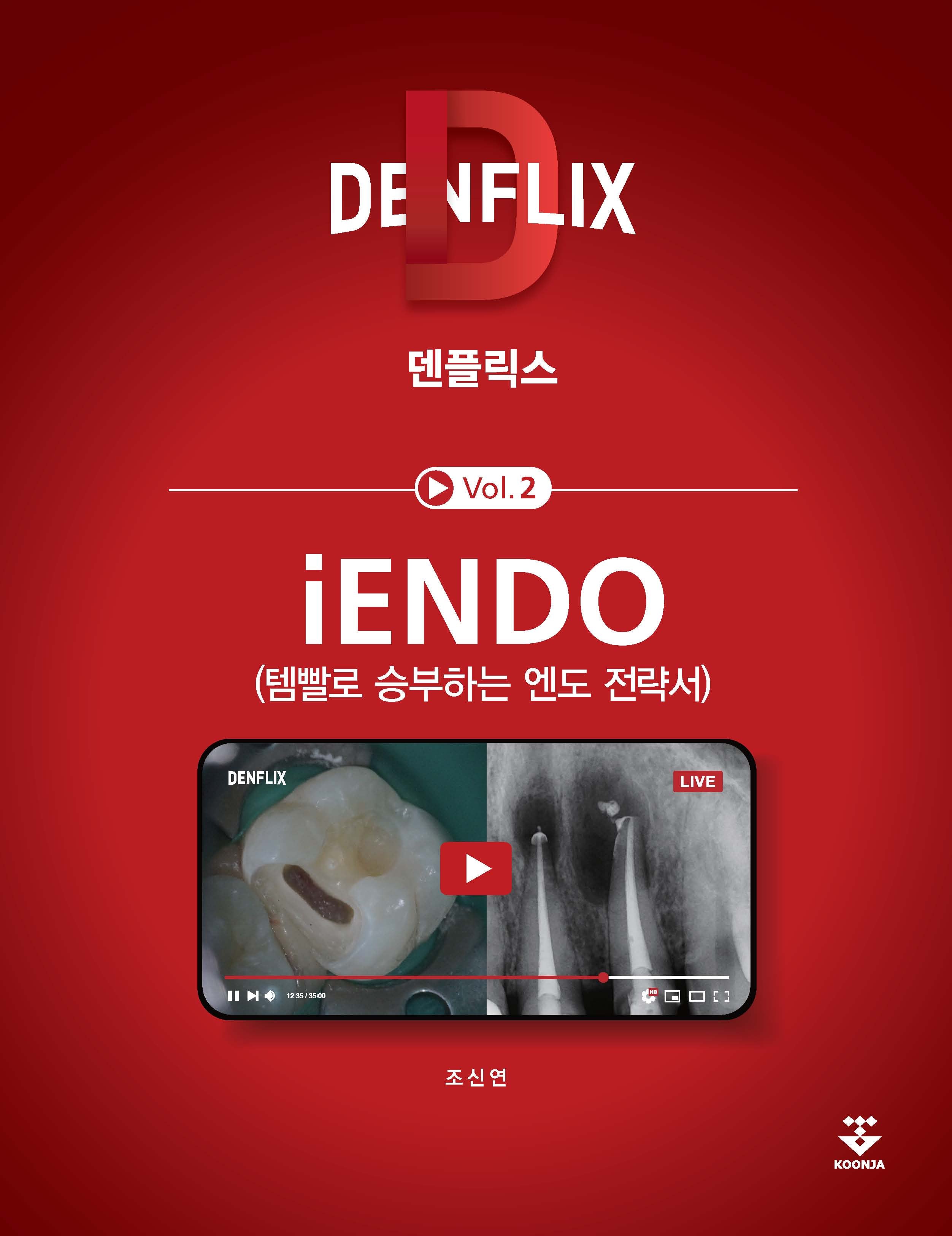 덴플릭스