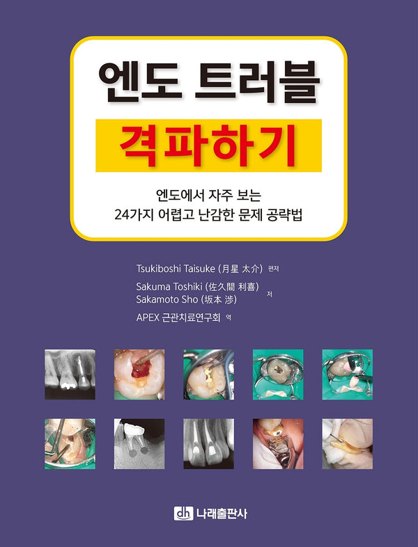 엔도 트러블 격파하기