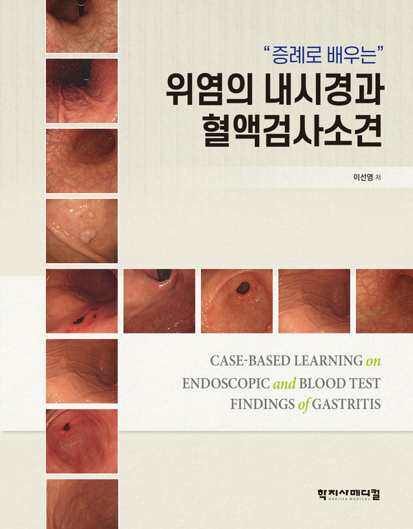 위염의 내시경과 혈액검사소견(증례로 배우는)(반양장)