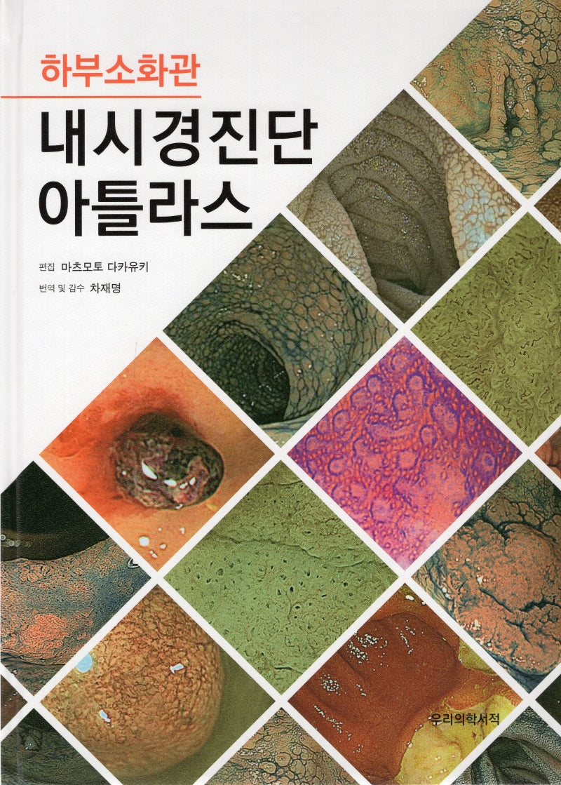 하부소화관 내시경진단 아틀라스(양장본 HardCover)