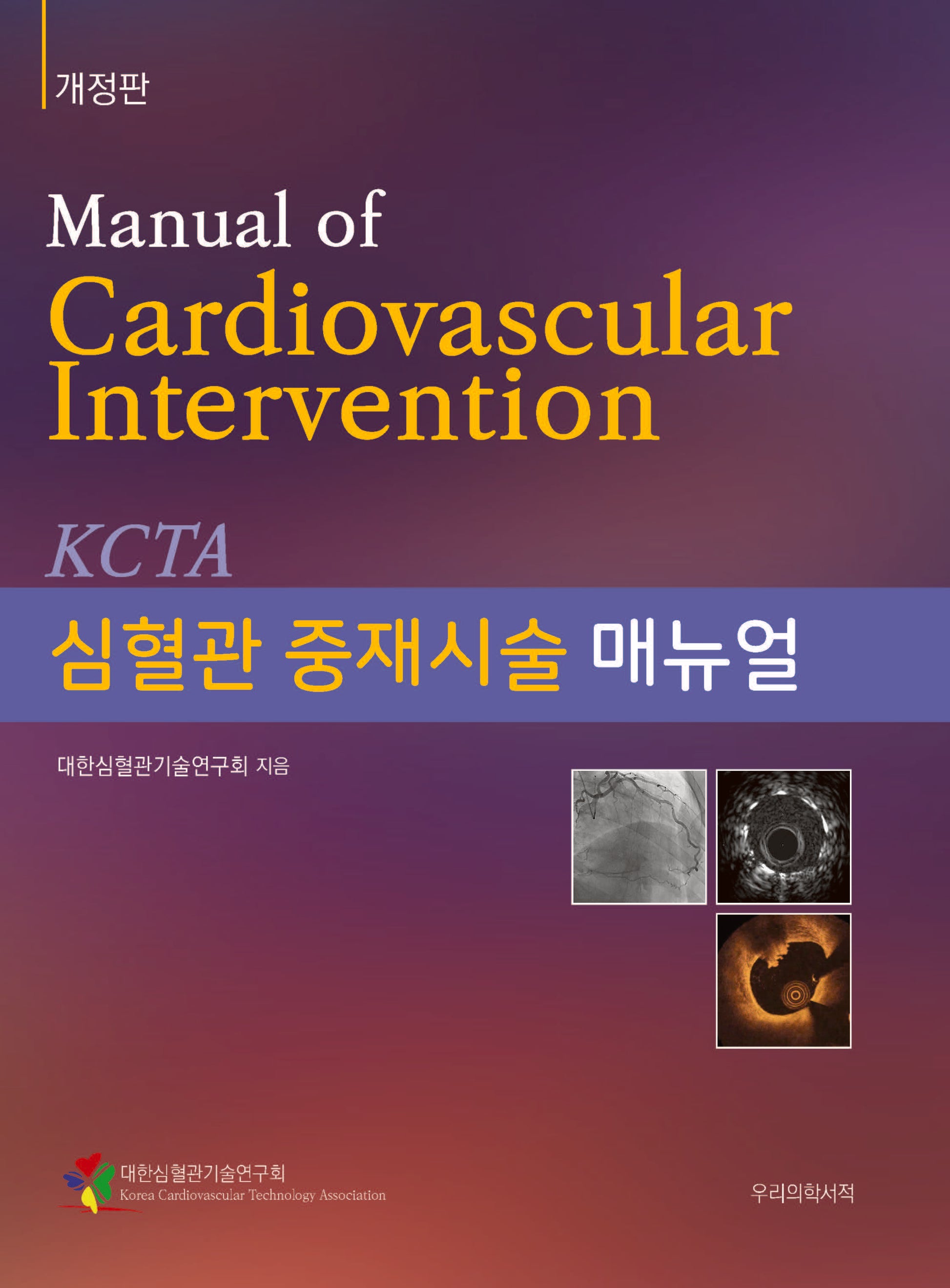 심혈관 중재시술 매뉴얼 개정판(개정판)(양장본 Hardcover)