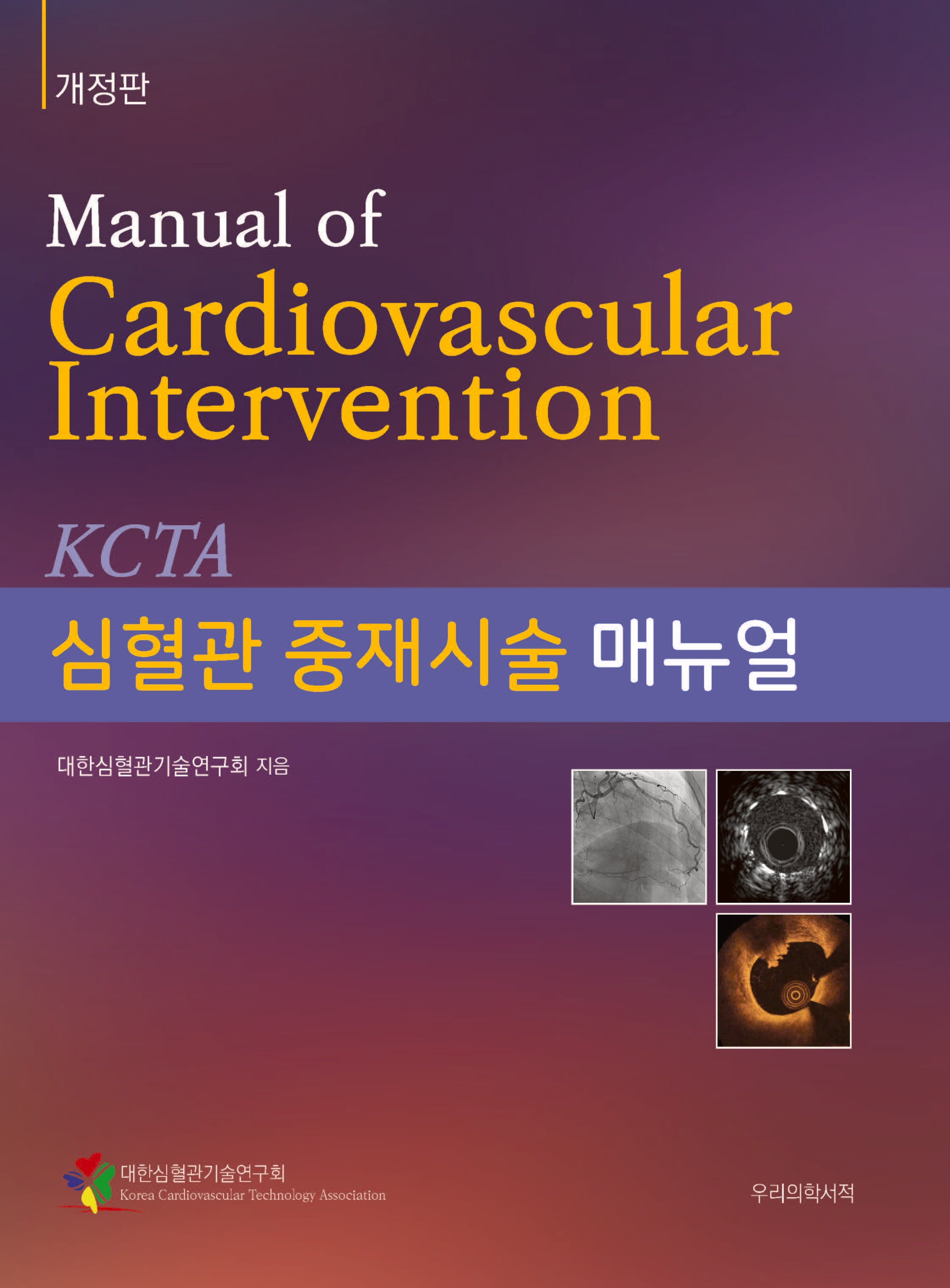 심혈관 중재시술 매뉴얼 개정판(개정판)(양장본 Hardcover)