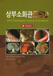 상부소화관 ESD(양장본 Hardcover)