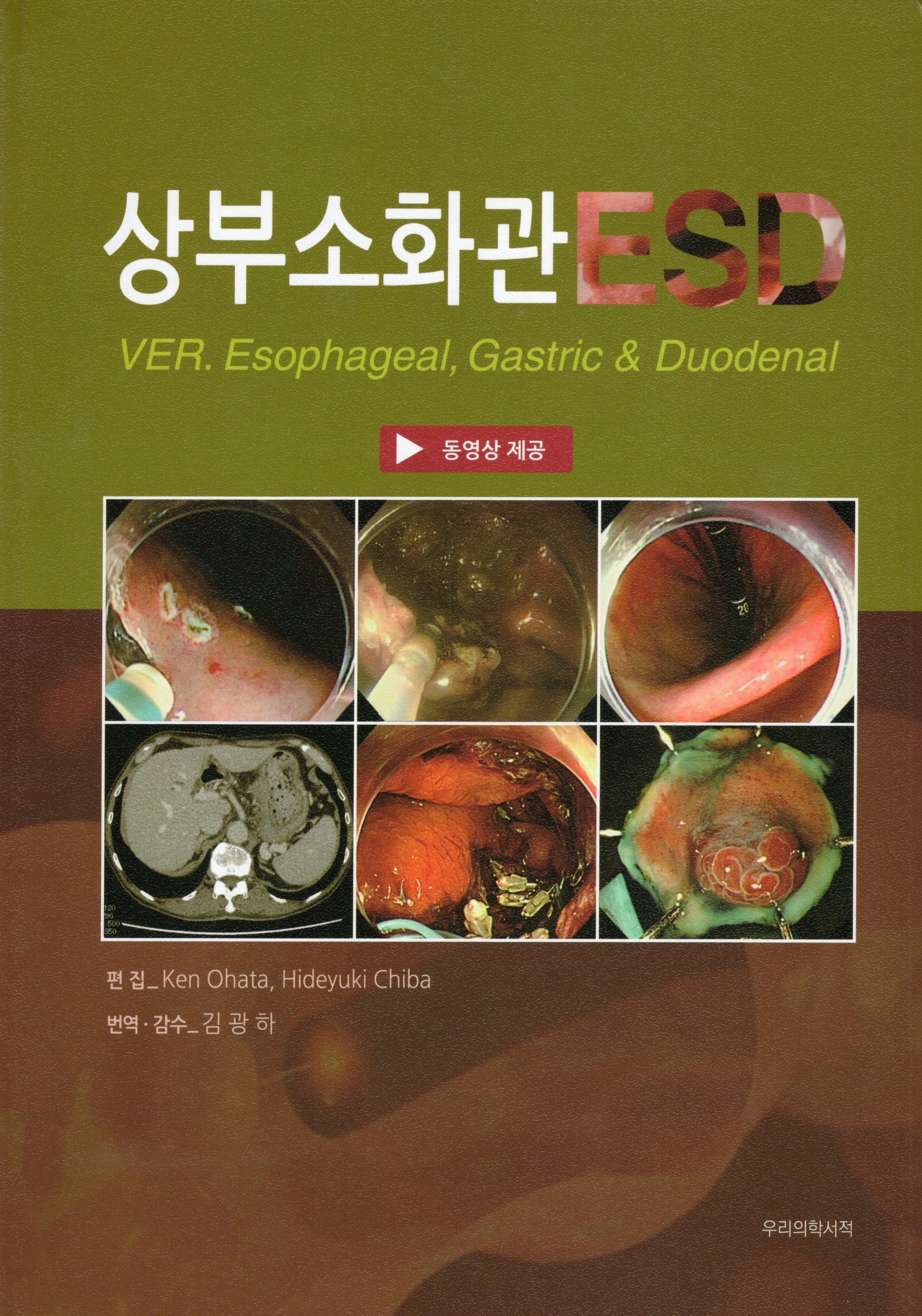상부소화관 ESD(양장본 Hardcover)