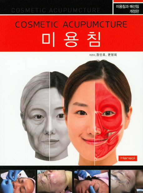 미용침(개정판)