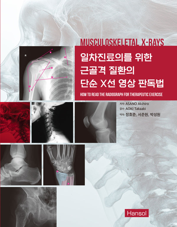 일차진료의를 위한 근골격 질환의 단순 X선 영상 판독법