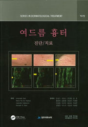 여드름 흉터 진단 치료(2판)