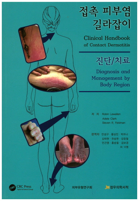 접촉 피부염 길라잡이